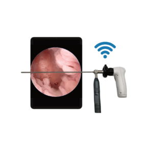 Sistema de Video Endoscópico WIFI